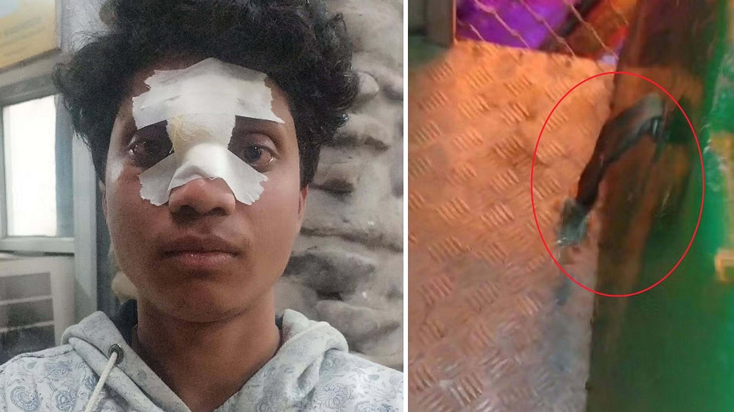 लेजर वैली में झूले की सीट बेल्ट टूटी