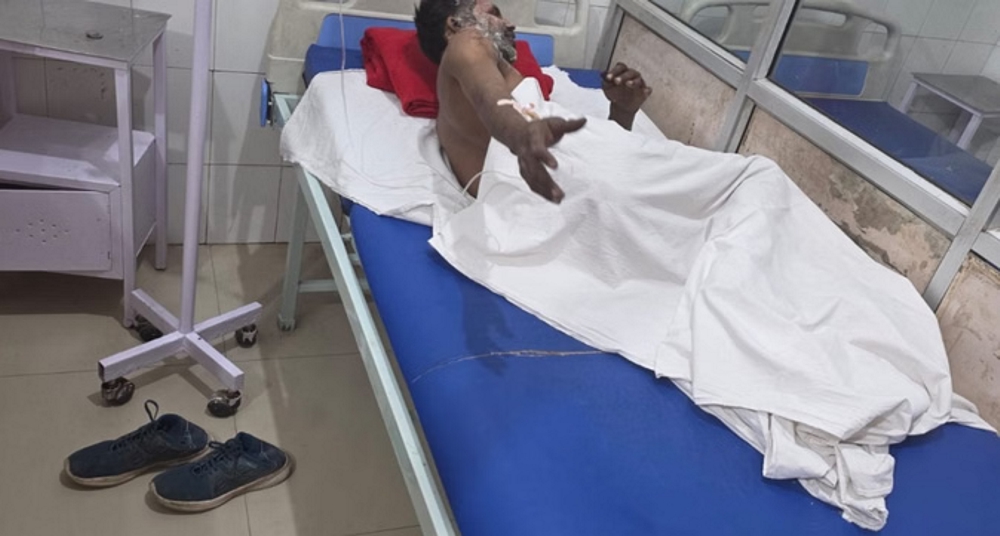 डिलीवरी बॉय ने खुद को लगाई आग, हालत नाजुक