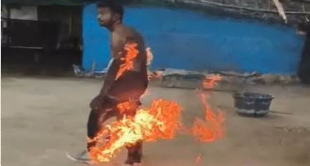 युवक ने खुद को लगाई आग, 40 फीसदी झुलसा